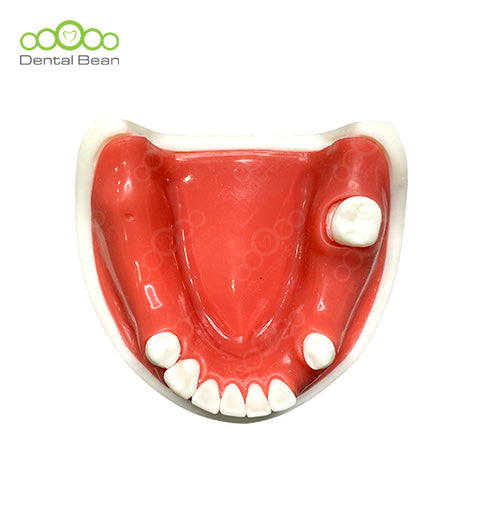 Dental bean Basic Model (Only Lower with Gum)