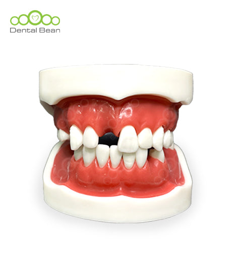 Dental bean Basic Model (with Gum)