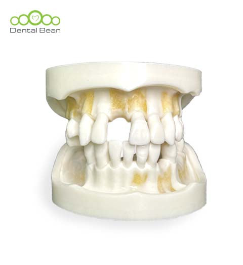 Dental bean Basic Model (Without Gum)