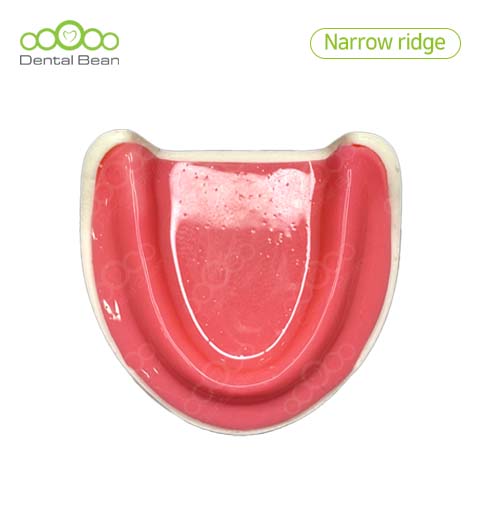 Dental bean Edentulous Narrow ridge Model (Only Lower with Gum)